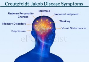 Creutzfeldt-Jakob-Disease-inner-image